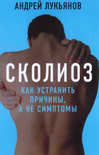 Сколиоз